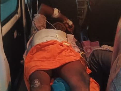 Electric Shock: सूअर मारने बिछाए गए करंट से युवक झुलसा, शरीर का 50% हिस्सा जला; बलरामपुर में RTO बैरियर पर हमला, 5 आरोपी पकड़ाए